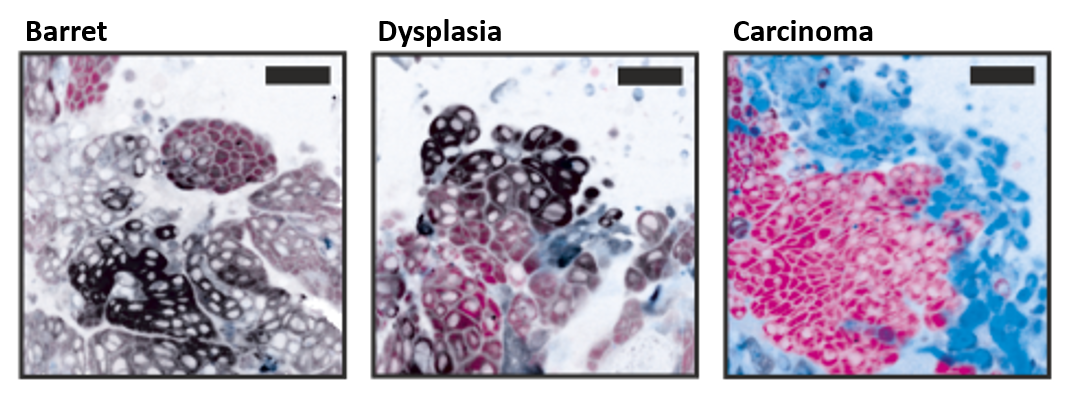 Digital histopathology imaging example